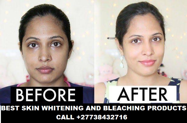 Permanent Skin Lightening+27738432716 Skin Whitening Pills Injection IN Pretoria Johannesburg Midrand Tembisa Soweto Cape Town Pietermaritzburg Durban Polokwane Witbank Bloemfontein Rustenburg